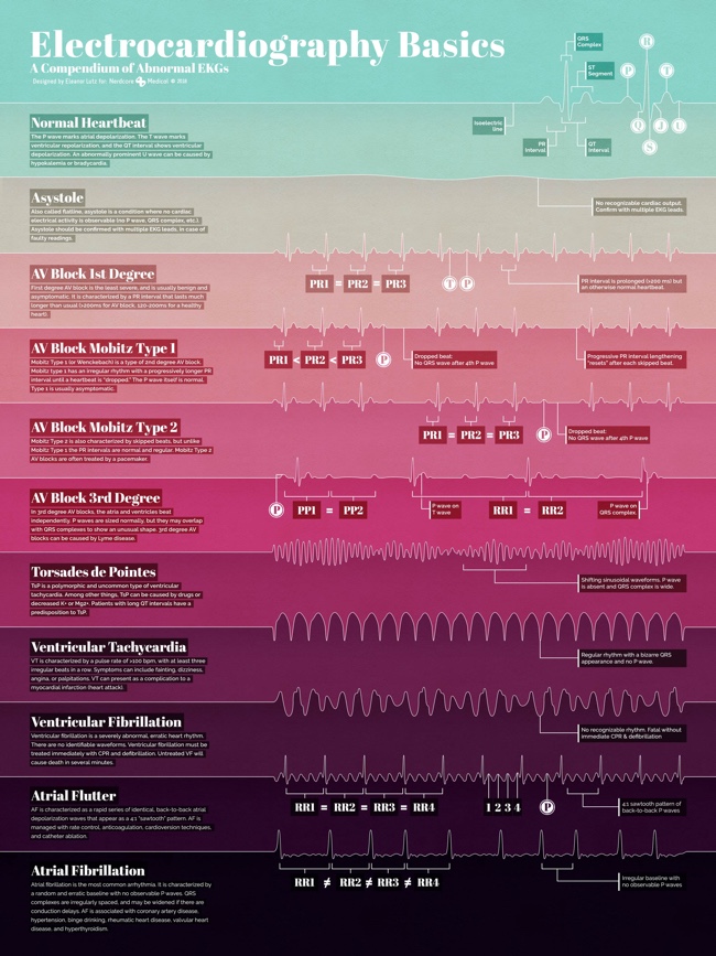 Electrocardiography Basics infographic science illustration poster